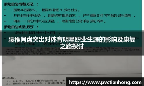 腰椎间盘突出对体育明星职业生涯的影响及康复之路探讨